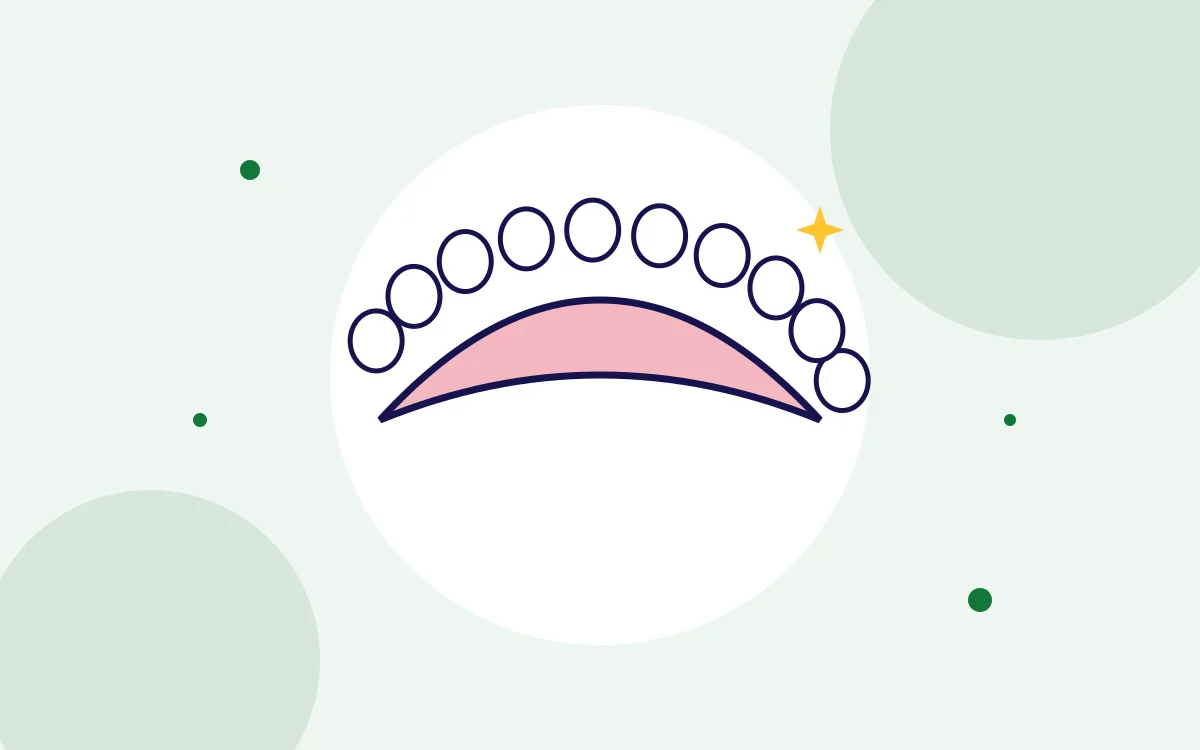 Illustration of a full denture for dentures