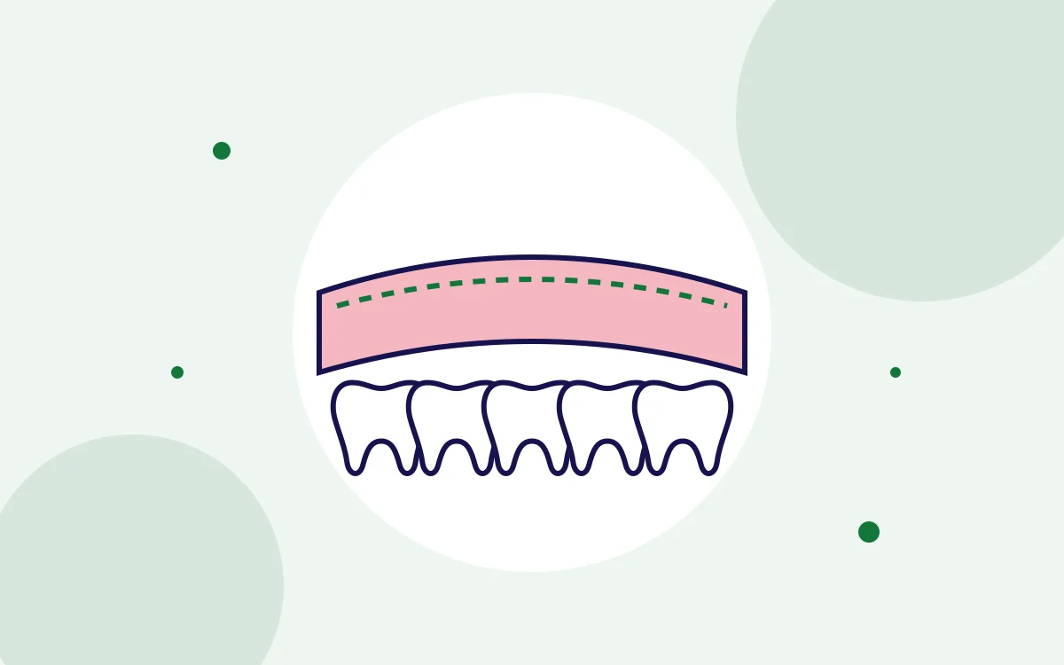 Illustration of healthy gums around a row of teeth for gum disease treatment
