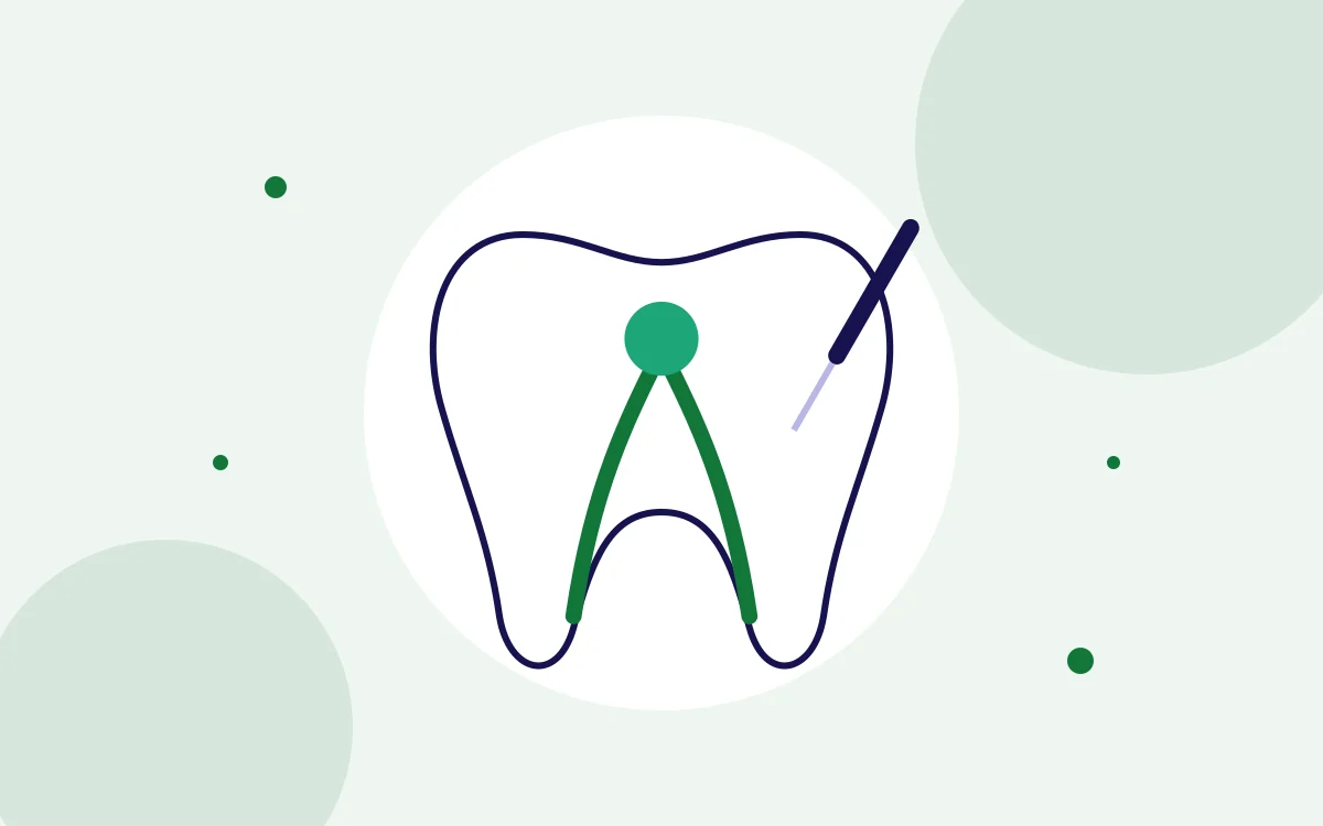 Illustration of root canal treatment inside a tooth for apicoectomy