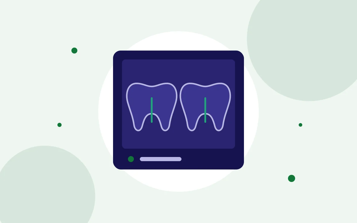 Illustration of a digital dental X-ray showing two teeth: Digital X-Rays